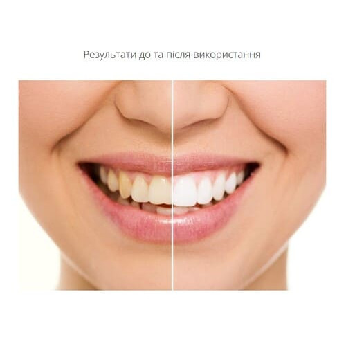  Набір: ультразвукова зубна щітка MEDICA + PROBRUSH 9.0 (ultrasonic-complete) white+fuchsia (Японія)