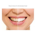  Набір: ультразвукова зубна щітка MEDICA + PROBRUSH 9.0 (ultrasonic-complete) white+fuchsia (Японія) - фото №2