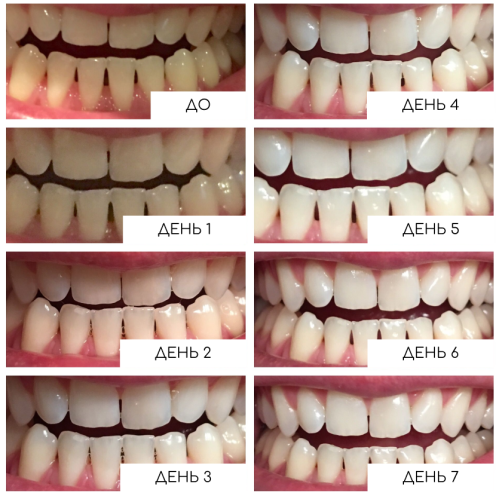 Відбілювальні смужки MEDICA+ 3DWhite Strips 