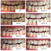 Відбілювальні смужки MEDICA+ 3DWhite Strips  - фото №6