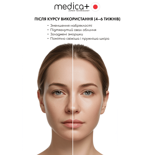 Мікрострумовий ліфтинг масажер для обличчя MEDICA+ Tri-Action 8.0