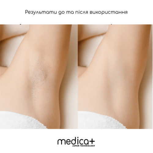 Фотоeпілятор MEDICA+ HAIRCLEANE 8.0 (ЯПОНІЯ)