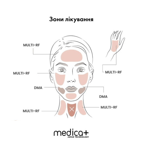 МІКРОСТРУМОВИЙ RF ЛІФТИНГ-МАСАЖЕР ДЛЯ ОБЛИЧЧЯ MEDICA+ SKIN LIFTING 7.0 PINK ЯПОНІЯ (EMS+LED)