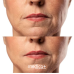 МІКРОСТРУМОВИЙ RF ЛІФТИНГ-МАСАЖЕР ДЛЯ ОБЛИЧЧЯ MEDICA+ SKIN LIFTING 7.0 PINK ЯПОНІЯ (EMS+LED) - фото №4